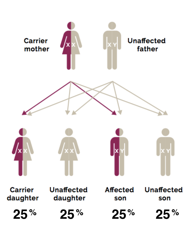 Graphic showing how Duchenne could run in a family, and is passed from the parent to the child. In the graphic the mother is the carrier and the father is unaffected. The children shown - 1 Carrier daughter 25%, ,2 Unaffected daughter 25%, 3 Affected son 25%, and 4 Unaffected son 25%